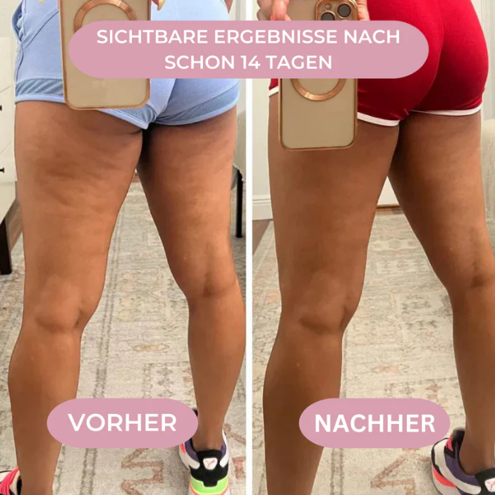 Lissea Anti Cellulite